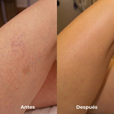 Elara crema autobronceante para piel madura