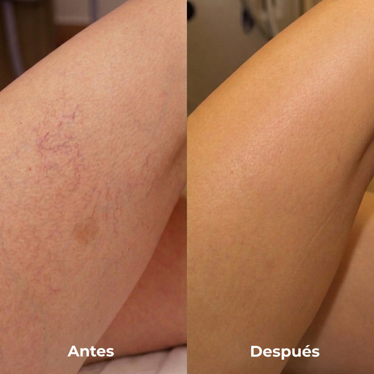 Elara crema autobronceante para piel madura